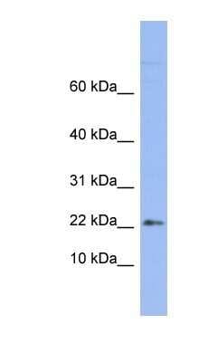 Western Blot: RPS24 Antibody [NBP1-57404]
