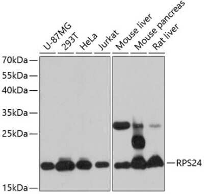 Western Blot: RPS24 AntibodyAzide and BSA Free [NBP2-93809]