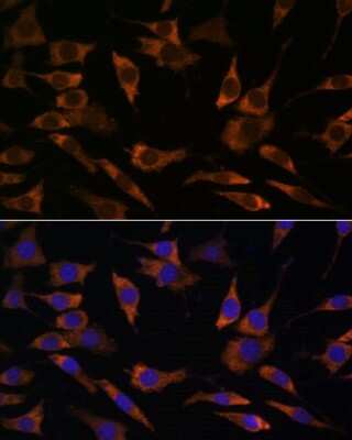 Immunocytochemistry/ Immunofluorescence: RPS25 Antibody - Azide and BSA Free [NBP2-93936]