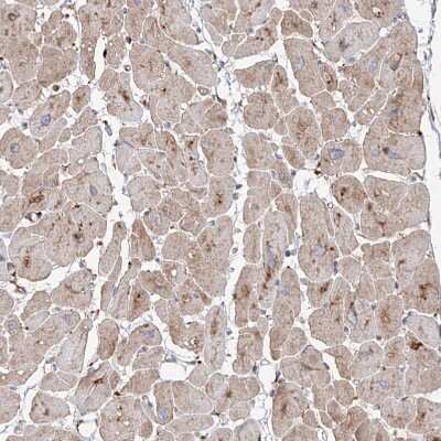 Immunohistochemistry-Paraffin: RPS25 Antibody [NBP1-80802]
