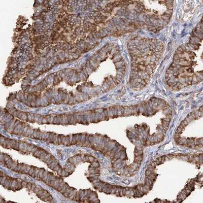 Immunohistochemistry-Paraffin: RPS25 Antibody [NBP1-80802]