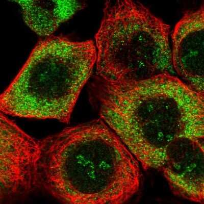 Immunocytochemistry/ Immunofluorescence: RPS26 Antibody [NBP1-92352]
