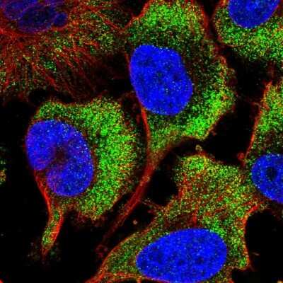 Immunocytochemistry/ Immunofluorescence: RPS26 Antibody [NBP2-55581]