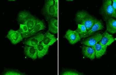 Immunocytochemistry/ Immunofluorescence: RPS26 Antibody [NBP3-13001]