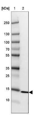 Western Blot: RPS26 Antibody [NBP1-92352]