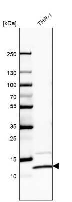 Western Blot: RPS27L Antibody [NBP2-57624]
