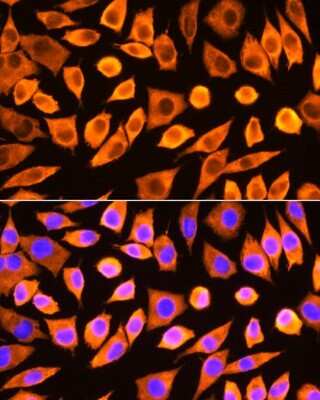 Immunocytochemistry/ Immunofluorescence: RPS3 Antibody - BSA Free [NBP2-93895]