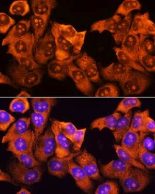 Immunocytochemistry/ Immunofluorescence: RPS3 Antibody - BSA Free [NBP2-94073]