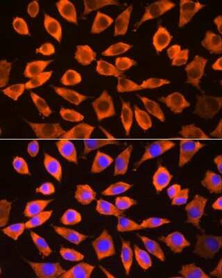 Immunocytochemistry/ Immunofluorescence: RPS3 Antibody - BSA Free [NBP2-94073]