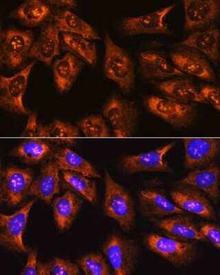 Immunocytochemistry/ Immunofluorescence: RPS3 Antibody - BSA Free [NBP2-94073]