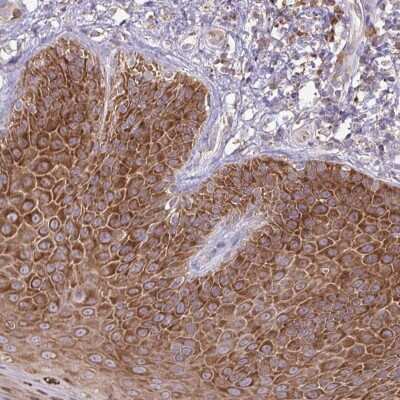 Immunohistochemistry: RPS3 Antibody [NBP2-38024]