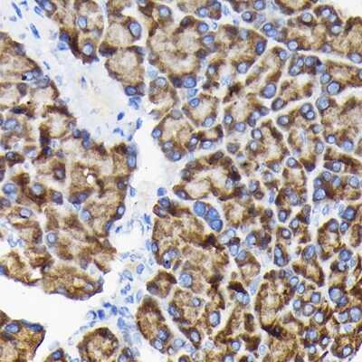 Immunohistochemistry-Paraffin: RPS3 Antibody - BSA Free [NBP2-94073]
