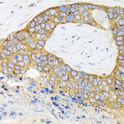 Immunohistochemistry-Paraffin: RPS3 Antibody - BSA Free [NBP2-94073]