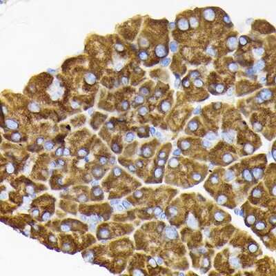 Immunohistochemistry-Paraffin: RPS3 Antibody - BSA Free [NBP2-94073]