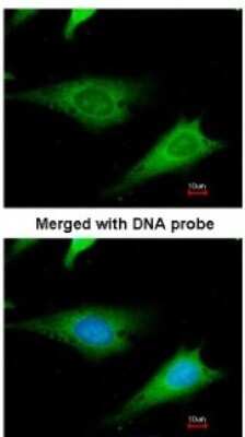 Immunocytochemistry/ Immunofluorescence: RPS3A Antibody [NBP1-31598]