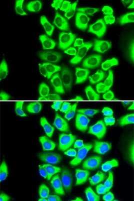 Immunocytochemistry/ Immunofluorescence: RPS3A Antibody - BSA Free [NBP2-94503]