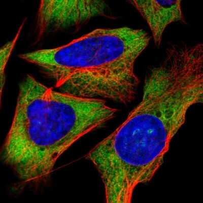 Immunocytochemistry/ Immunofluorescence: RPS5 Antibody [NBP2-49198]