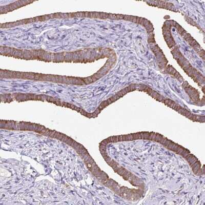 Immunohistochemistry-Paraffin: RPS5 Antibody [NBP2-49198]