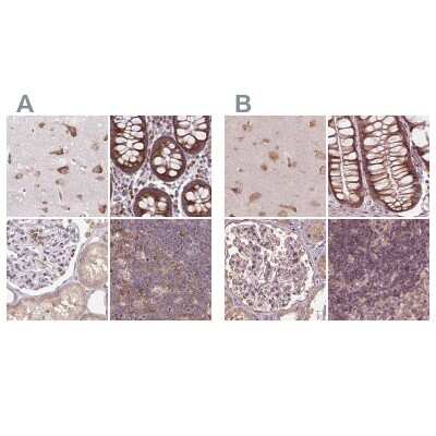 Immunohistochemistry-Paraffin: RPS5 Antibody [NBP2-49198]