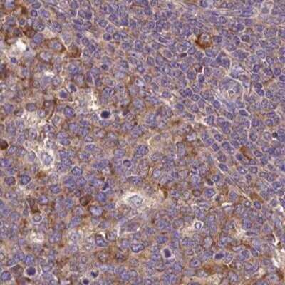 Immunohistochemistry-Paraffin: RPS5 Antibody [NBP2-49198]