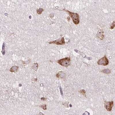 Immunohistochemistry-Paraffin: RPS5 Antibody [NBP2-49198]
