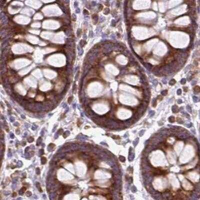 Immunohistochemistry-Paraffin: RPS5 Antibody [NBP2-49198]