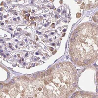 Immunohistochemistry-Paraffin: RPS5 Antibody [NBP2-49198]