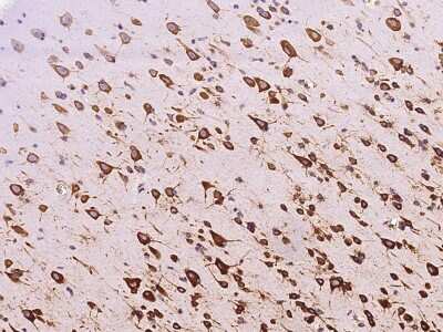 Immunohistochemistry-Paraffin: RPS5 Antibody [NBP2-97627]
