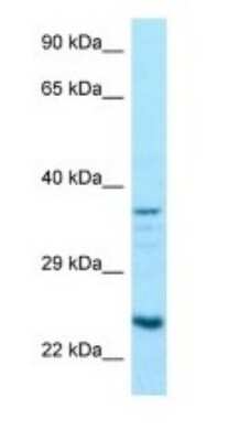 Western Blot: RPS5 Antibody [NBP1-98403]