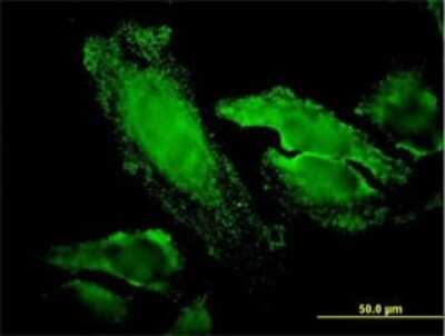 Immunocytochemistry/ Immunofluorescence: RPS7 Antibody (3G4) [H00006201-M03]