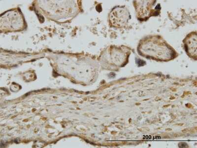 Immunohistochemistry-Paraffin: RPS7 Antibody (3G4) [H00006201-M03]