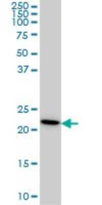 Western Blot: RPS7 Antibody (3G4) [H00006201-M03]