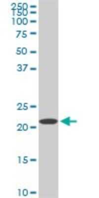 Western Blot: RPS7 Antibody (3G4) [H00006201-M03]