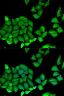 Immunocytochemistry/ Immunofluorescence: RPS7 Antibody - BSA Free [NBP2-94119]
