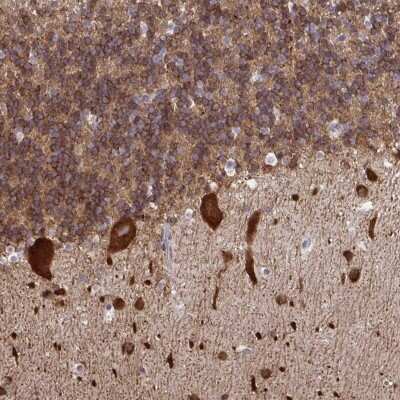 Immunohistochemistry-Paraffin: RPS7 Antibody [NBP2-33793]