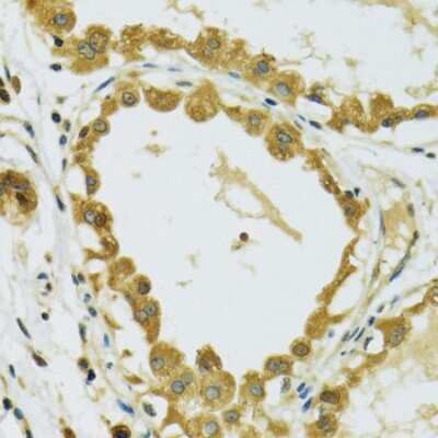 Immunohistochemistry-Paraffin: RPS7 Antibody - BSA Free [NBP2-94119]
