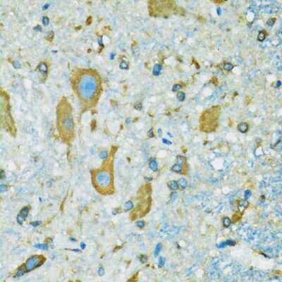 Immunohistochemistry-Paraffin: RPS7 Antibody - BSA Free [NBP2-94119]