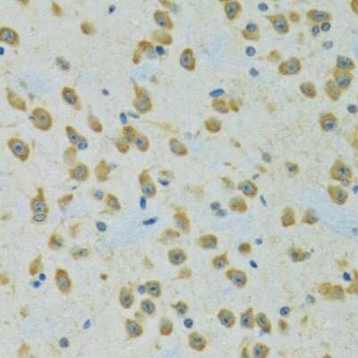 Immunohistochemistry-Paraffin: RPS7 Antibody - BSA Free [NBP2-94119]