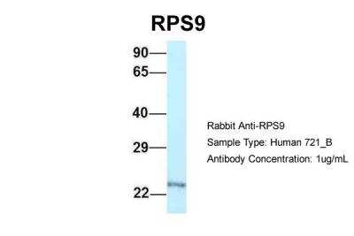 Western Blot: RPS9 Antibody [NBP2-88192]