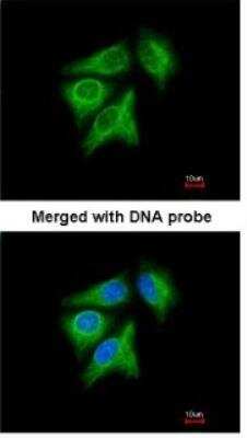 Immunocytochemistry/ Immunofluorescence: p40 Antibody [NBP1-32956]