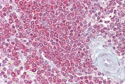 Immunohistochemistry-Paraffin: RPSA Antibody [NBP1-59114]