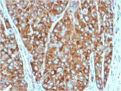Immunohistochemistry-Paraffin: RPSA Antibody (RPSA/2699) - Azide and BSA Free [NBP2-79854]