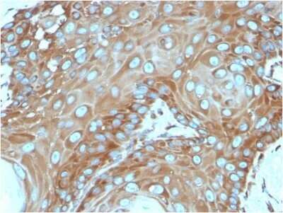 Immunohistochemistry-Paraffin: RPSA Antibody (RPSA/2699) - Azide and BSA Free [NBP2-79854]