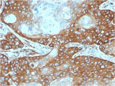 Immunohistochemistry-Paraffin: RPSA Antibody (RPSA/2699) - Azide and BSA Free [NBP2-79854]