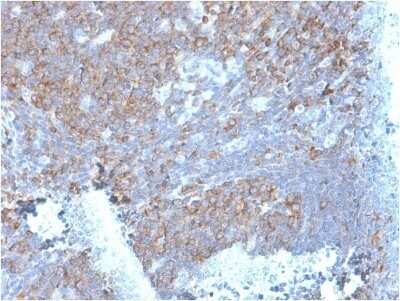 Immunohistochemistry-Paraffin: RPSA Antibody (RPSA/2699) - Azide and BSA Free [NBP2-79854]