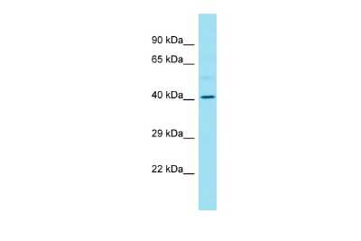 Western Blot: RPSA Antibody [NBP1-59114]