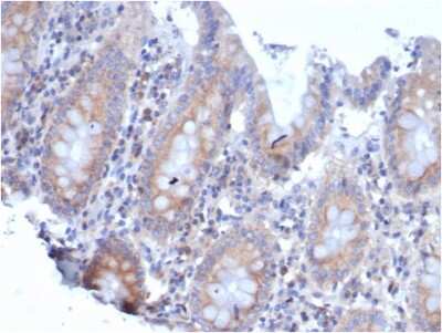 Immunohistochemistry-Paraffin: RPSA Antibody (rRPSA/6333) [NBP3-07247]