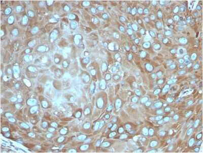 Immunohistochemistry-Paraffin: RPSA Antibody (rRPSA/6333) [NBP3-07247]