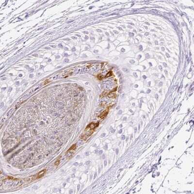 Immunohistochemistry-Paraffin: RPTN Antibody [NBP1-93792]