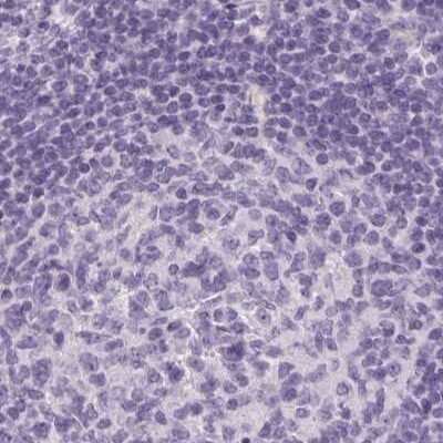 Immunohistochemistry-Paraffin: RPTN Antibody [NBP1-93792]